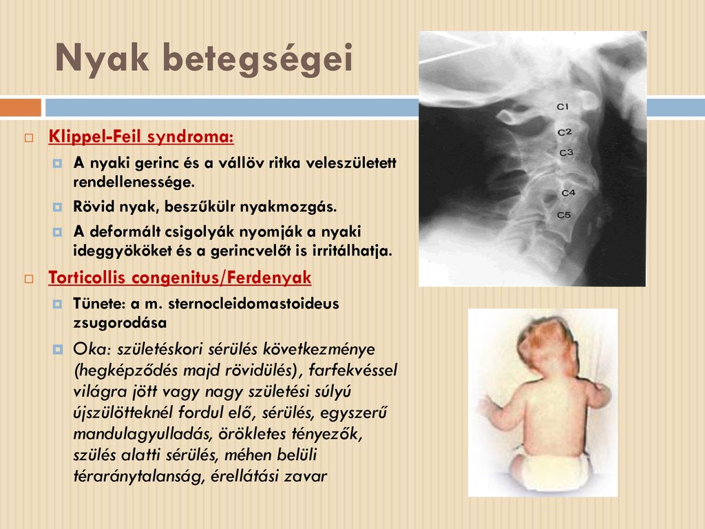 a nyaki gerinc betegségei)